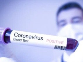 На Сумщині 78 221 випадок захворювання на коронавірусну інфекцію