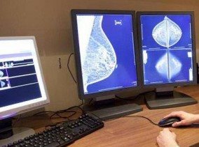 Бесплатную маммографию можно пройти в Сумах